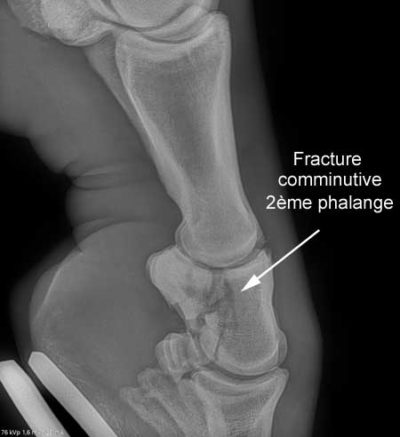 fracture-phalange-cheval